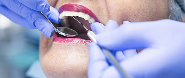 Best Emergency Tooth Extraction in Holiday City South, NJ